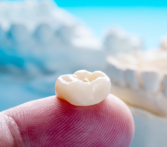 A dental crown in Fort Worth resting on a person’s finger