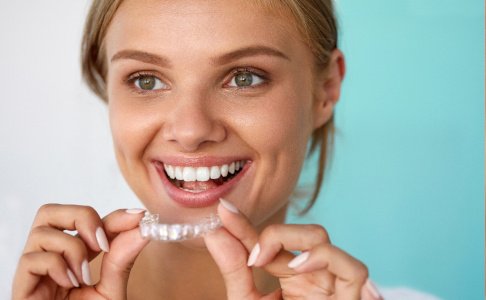 A smiling woman with white teeth holding a whitening tray